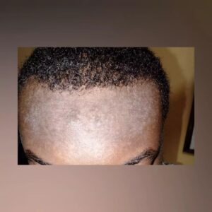 Emeka testimonial